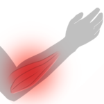 Arm