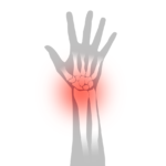 Hand
