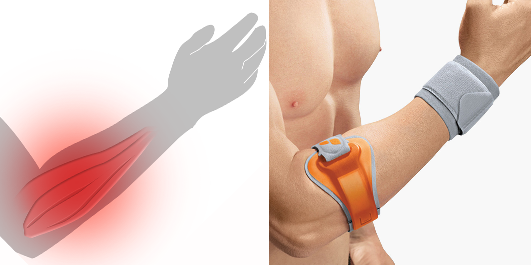 Epi-Hit – kombinerar armband med handledsband